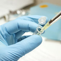 DNA forenzní test, určení pohlaví a shody dvou vzorků